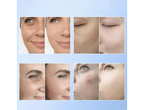 BIO COLLAGEN nawilżająca maseczka kolagenowa na twarz z kwasem hialuronowym - 3